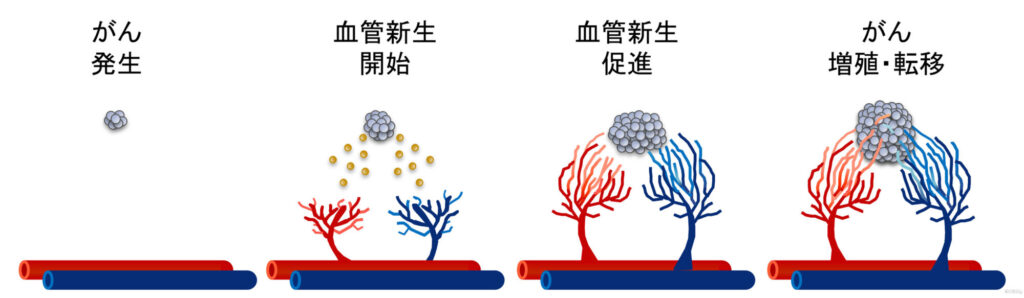 Cancer ＆ Angiogenesis