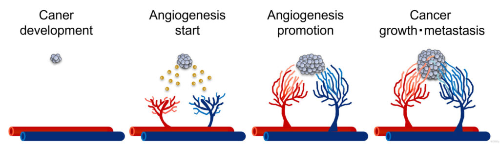 Cancer ＆ Angiogenesis